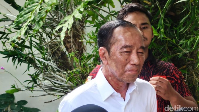 Mantan Presiden Republik Indonesia Jokowi, Sakit Apa? Ini Kata Ahli Kesehatan